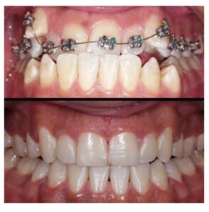 Perfect Alignment - Dr. Ankita Jindal Poddar