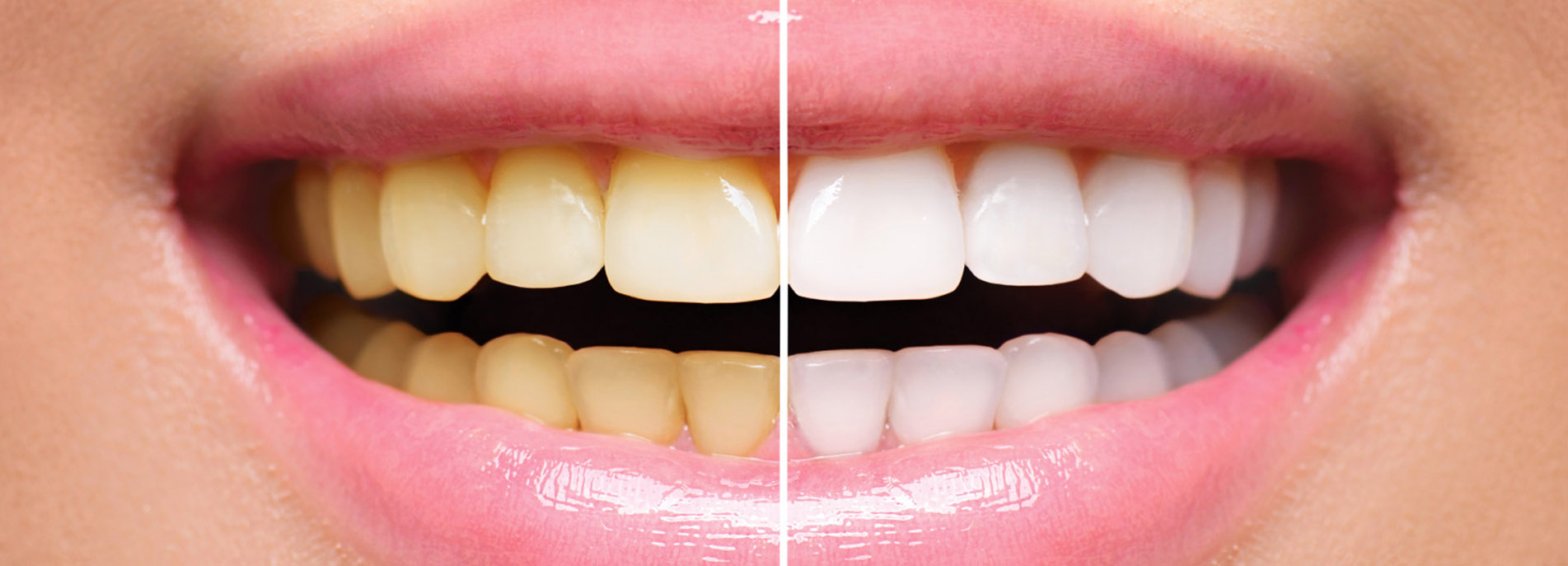 How to maintain healthy and white teeth