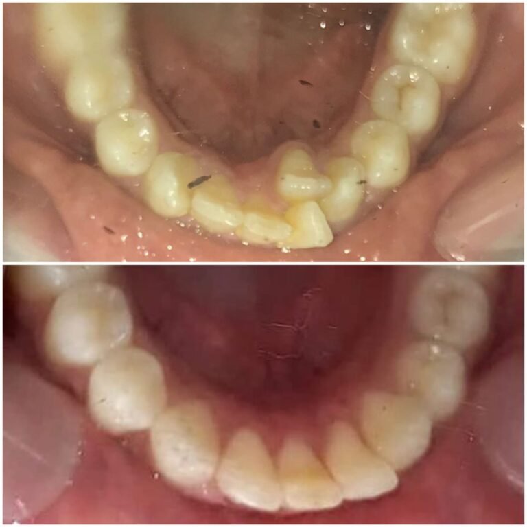 Aligned in 6 Months - Dr. Ankita Jindal