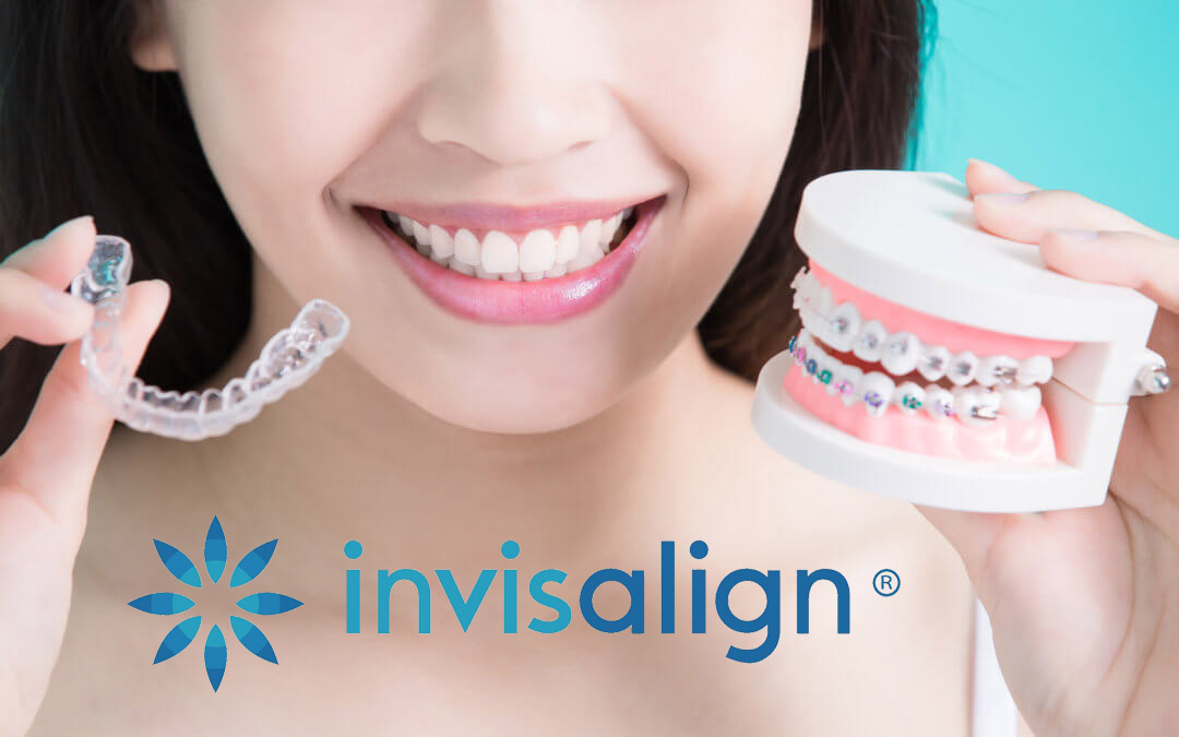 invisaligntreatmentcostindia