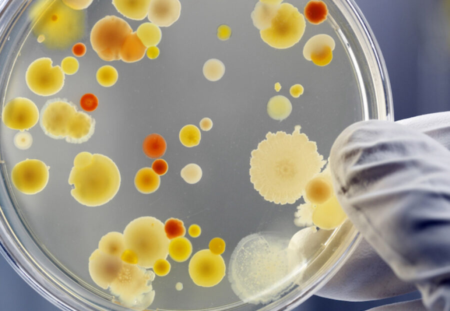 The Rising Threat of Antimicrobial Resistance