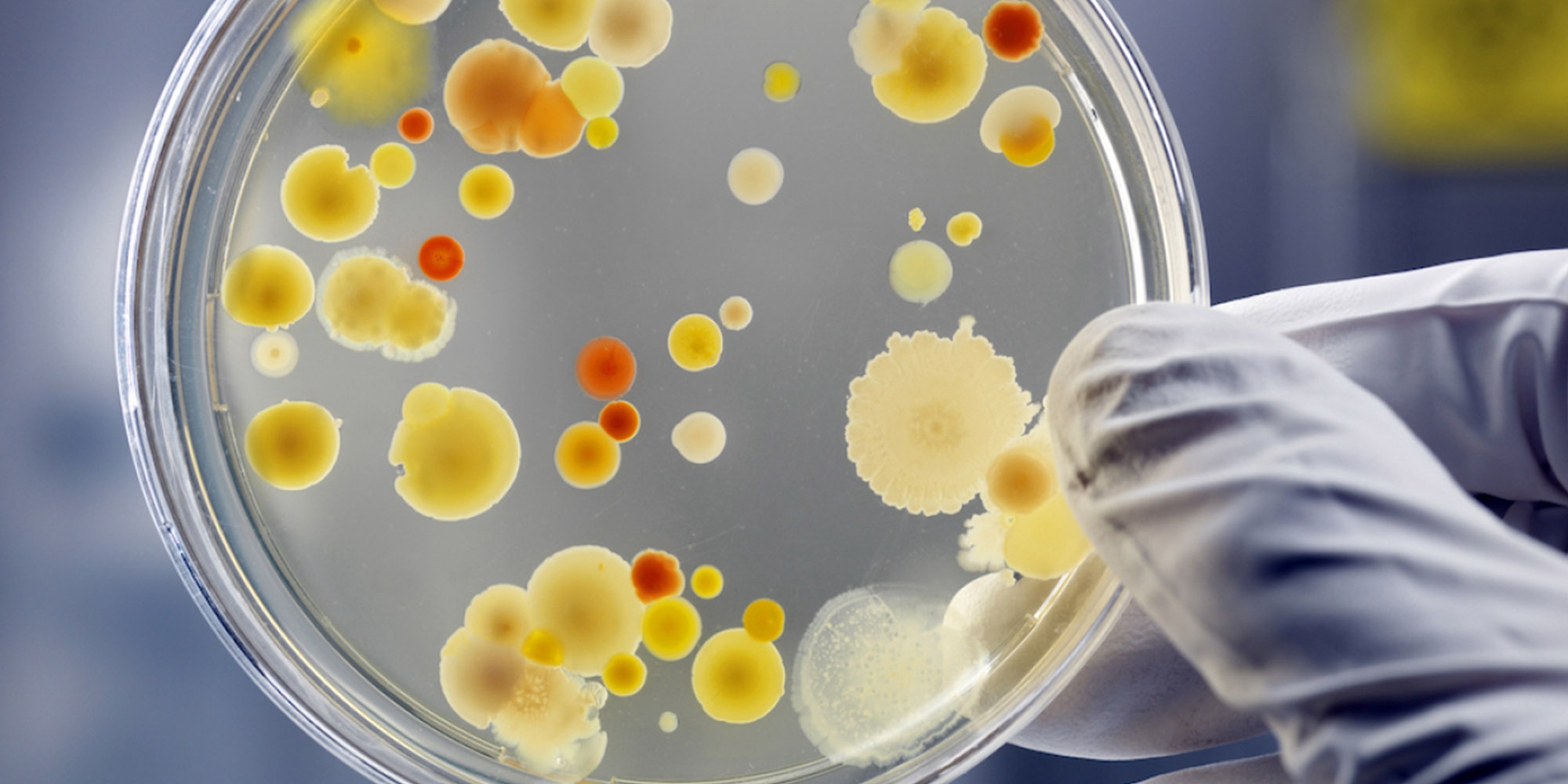 The Rising Threat of Antimicrobial Resistance