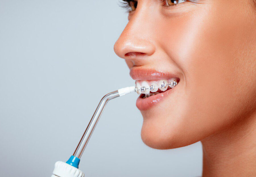 water flosser for teeth in delhi