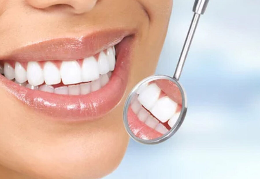 Cost of Smile Makeovers