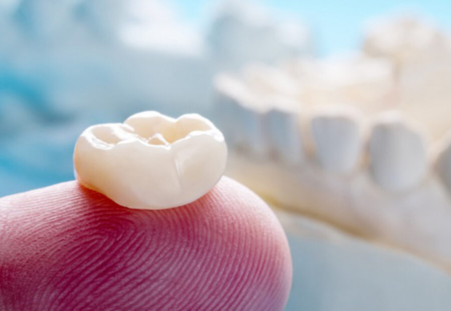 permanent teeth cap price