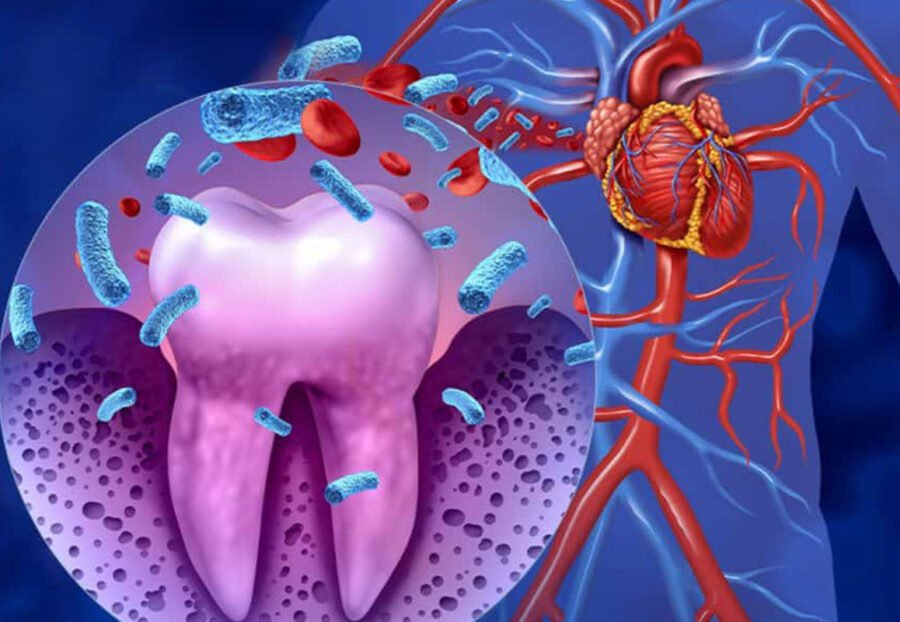 Gum Health & Its Link to Heart Disease