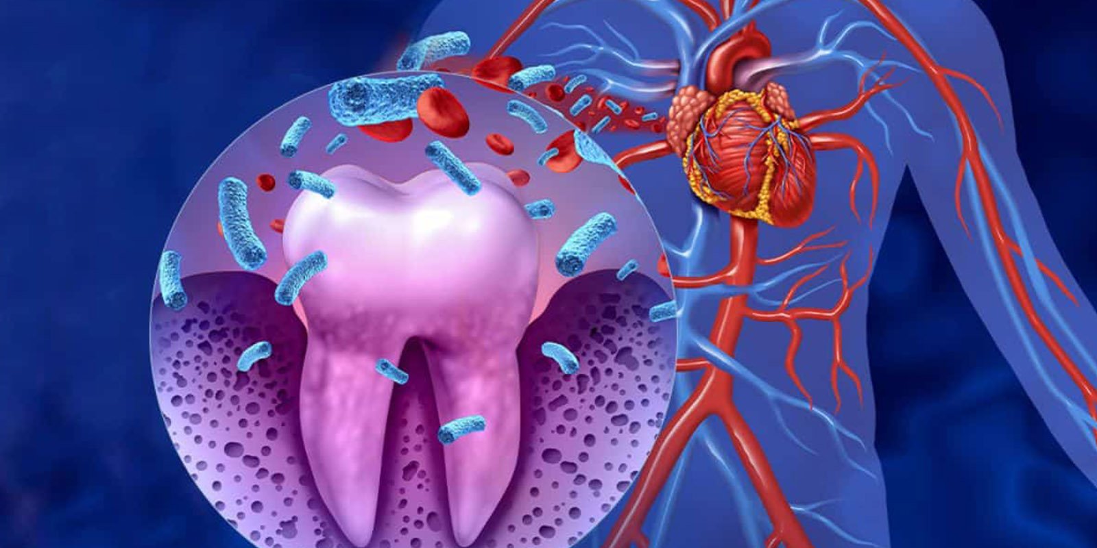 Gum Health & Its Link to Heart Disease