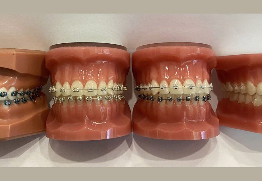 best dental clinic in delhi for Braces