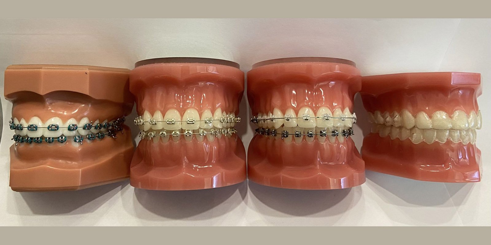 best dental clinic in delhi for Braces