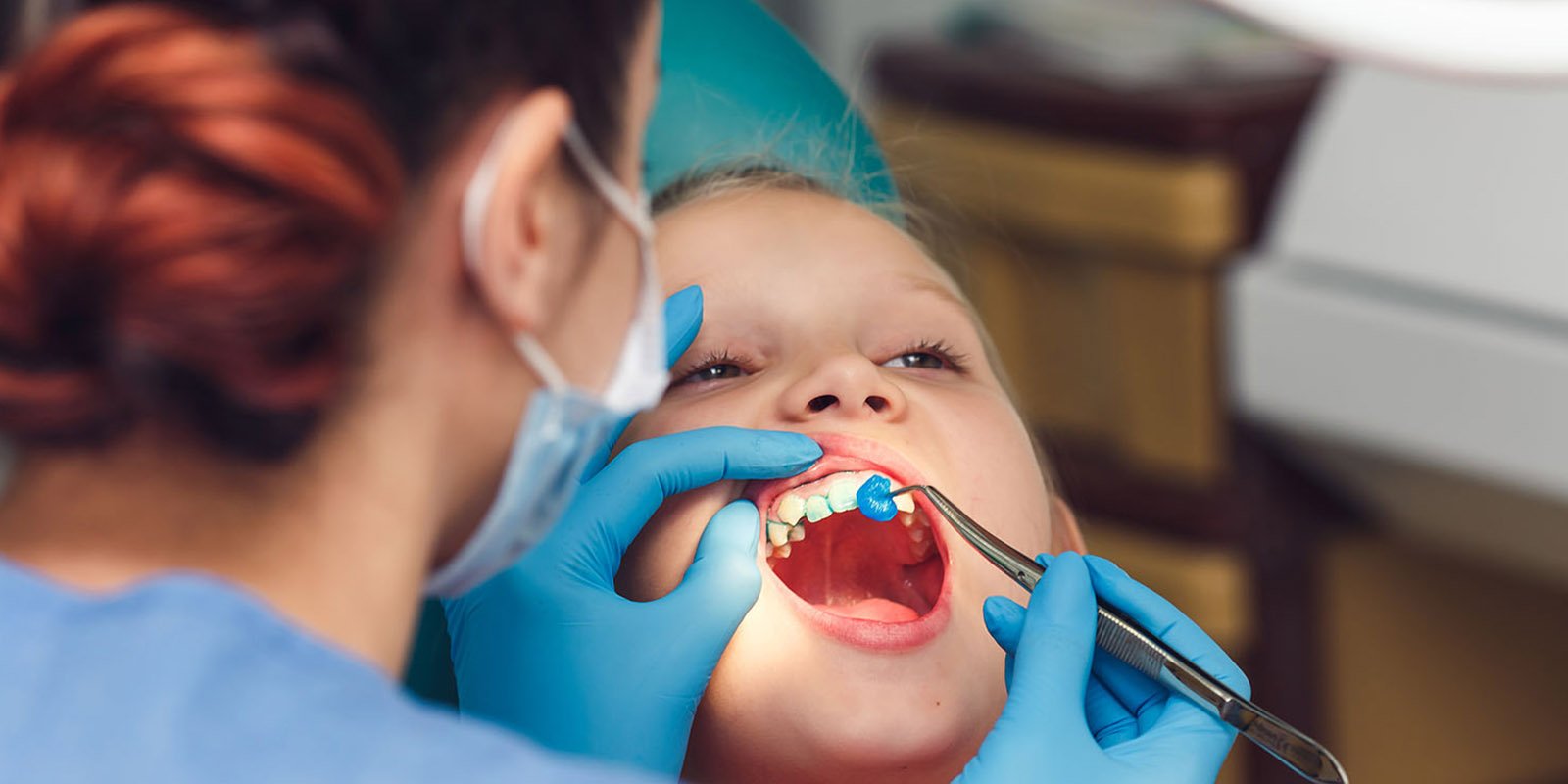 Fluoride Application in Kids