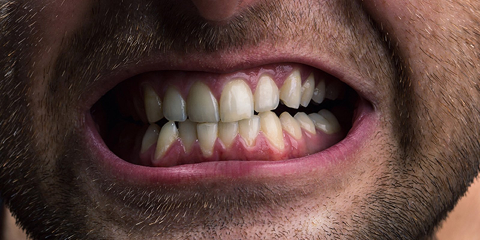 North Delhi Dental Clinic