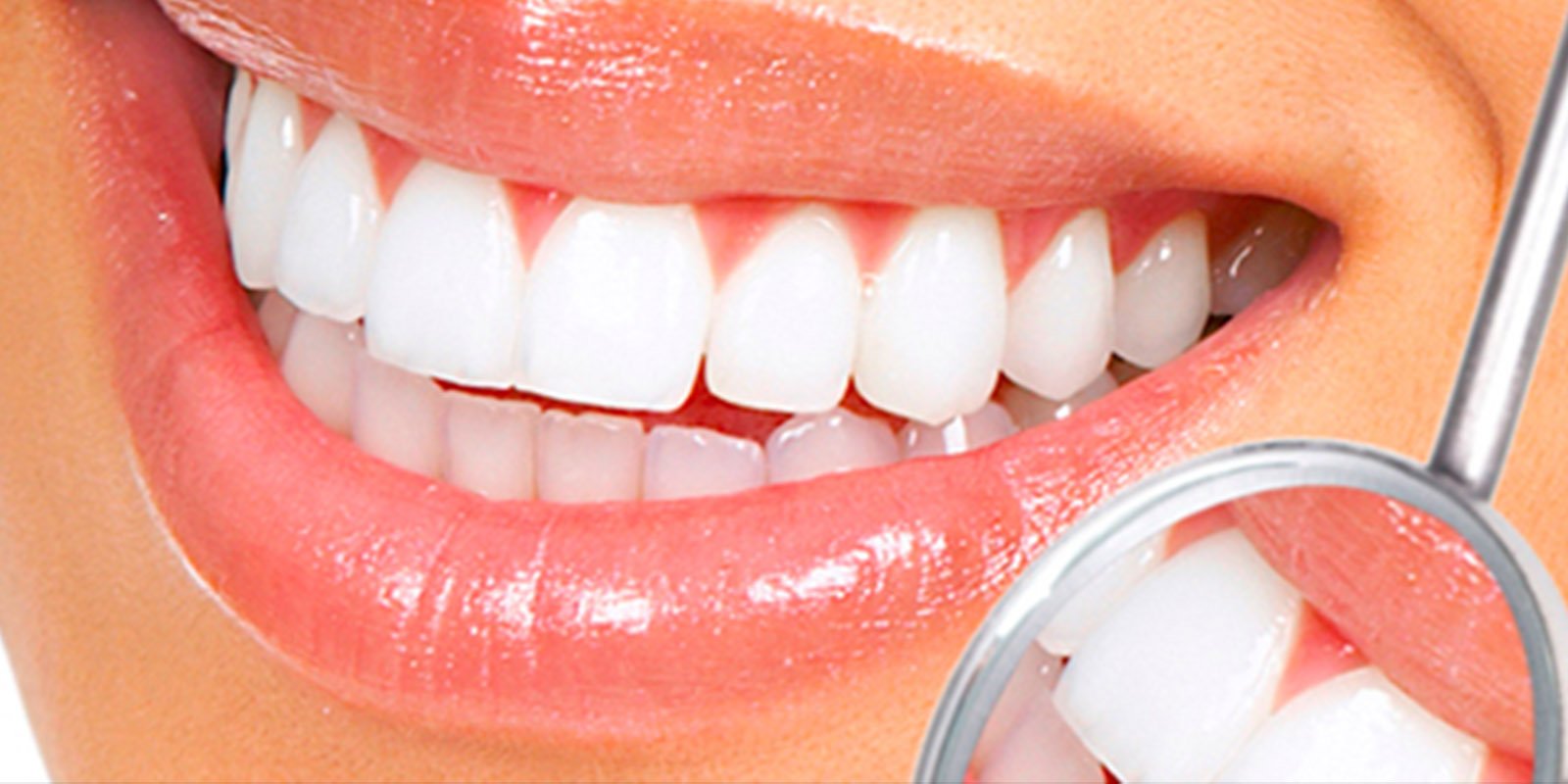 Teeth Bright After Cleaning or Whitening