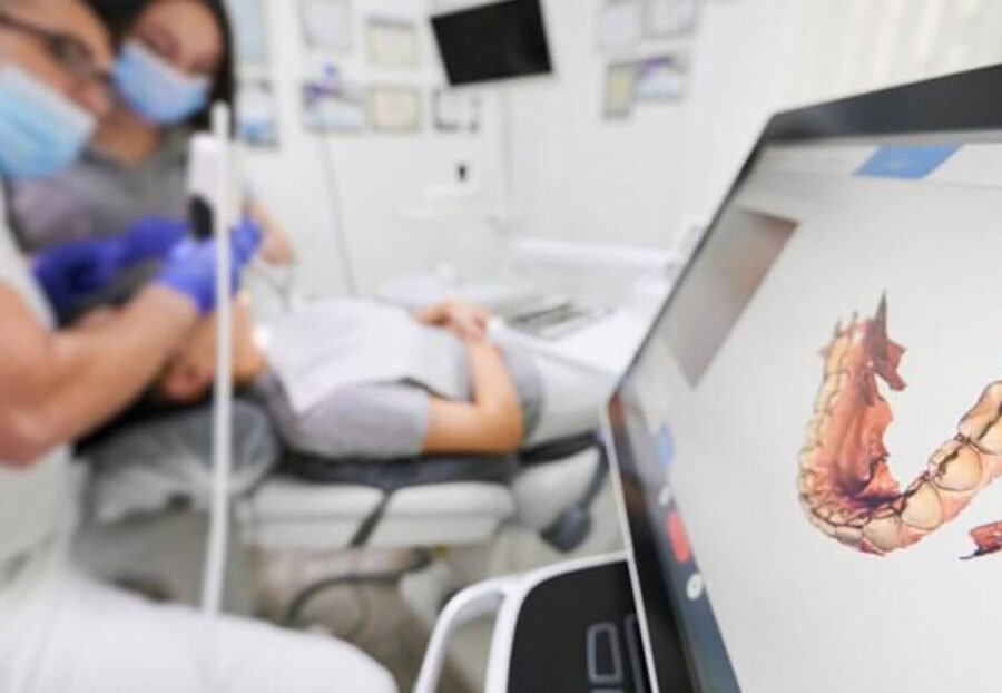 digital dental impressions